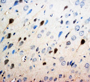 Neurotrophin 3/NTF3 Antibody