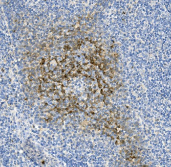 Anti-NCR1 Antibody