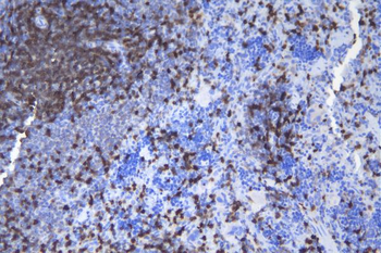 Anti-CD5 Antibody