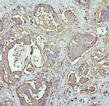 Anti-CEACAM5 Antibody