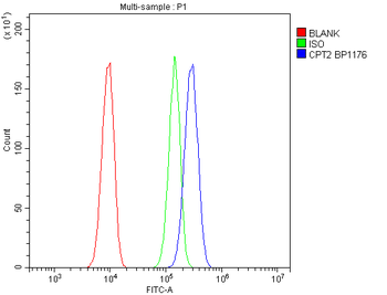 Anti-CPT2/CPT1 Antibody