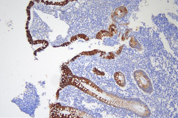 Anti-Cytokeratin 20/Krt20 Antibody