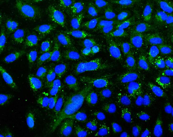 Anti-UGT1A6 Antibody