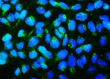 Anti-Mitofusin 1 MFN1 Antibody (monoclonal, 3H3)