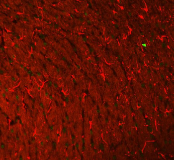 Anti-GFAP Antibody (monoclonal, 3F2)