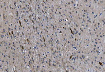 Anti-Choline Acetyltransferase/Chat Antibody