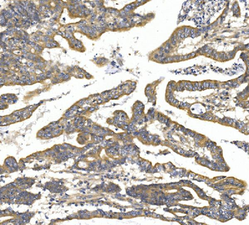 Anti-TTK/Mps1/TTK Antibody
