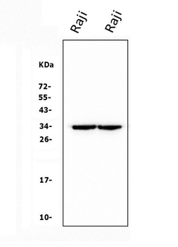 CD79b Antibody(monoclonal, 6H11)