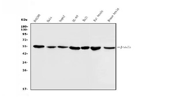 Beta Tubulin Antibody(monoclonal, 5E4)