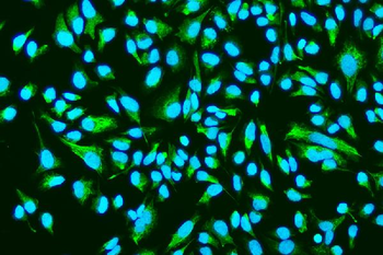 Anti-ASAH1 Antibody