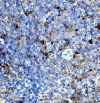 Anti-CCR2 Antibody