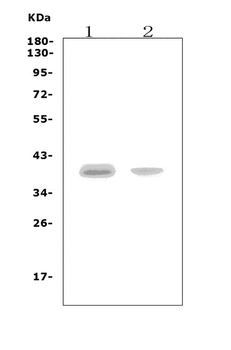 Anti-CCR5 Antibody