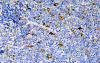 Anti-CCR6 Antibody