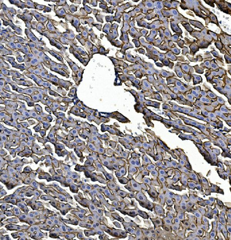 Anti-EGFR Antibody