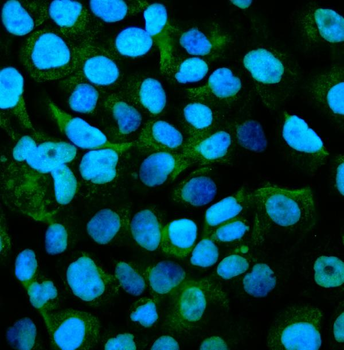 Anti-GPNMB/Gpnmb Antibody
