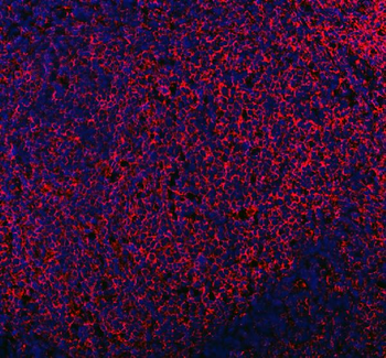Anti-Mannose Receptor/MRC1 Antibody