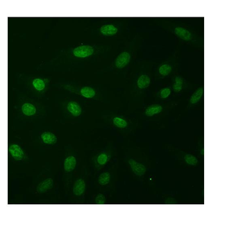 Anti-Natriuretic Peptide Receptor A/GC-A/NPR1 Antibody