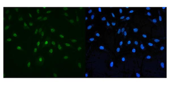 Anti-PAF1/PD2 Antibody