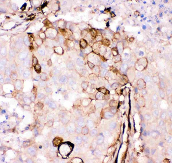 Anti-Gelsolin/GSN Antibody