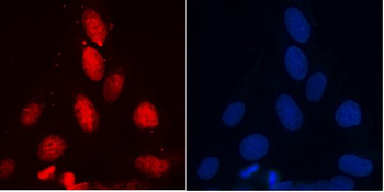 Anti-RENT1/hUPF1 Antibody (monoclonal, 11E7)
