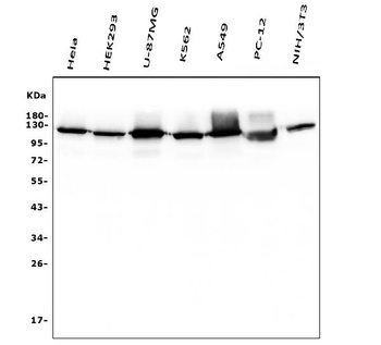 Hexokinase 1/HK1 Antibody (monoclonal, 2I4)
