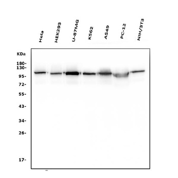 Hexokinase 1/HK1 Antibody (monoclonal, 4B7)