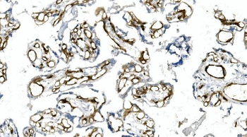 Anti-CD146/MCAM Antibody (monoclonal, 2H12)