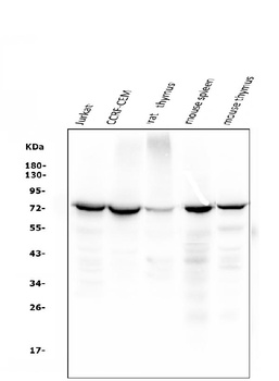 ZAP70 Antibody (monoclonal, 9D5)