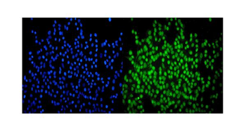 Anti-SMARCA2/BRM Antibody (monoclonal, 4E8)