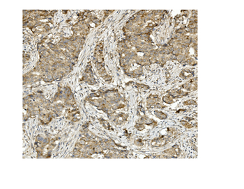 Anti-Methylmalonyl Coenzyme A mutase Antibody (monoclonal, 2D6)