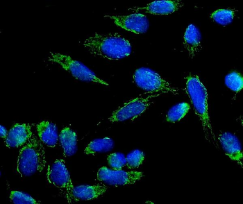 Anti-beta 3 Adrenergic Receptor/ADRB3 Antibody