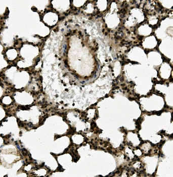 Anti-Aryl hydrocarbon Receptor/AHR Antibody