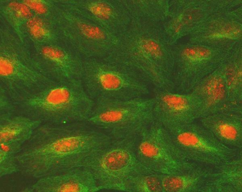 Anti-ALKBH5 Antibody
