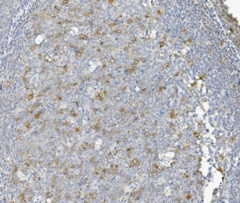Anti-Cyclin B1/CCNB1 Antibody