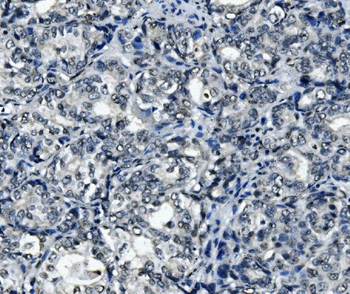Anti-RNA Helicase A/DHX9 Antibody