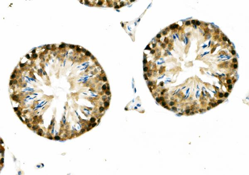 Anti-DNAJA2 Antibody