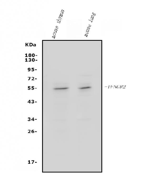 Anti-IFN gamma Receptor beta/AF-1/IFNGR2 Antibody