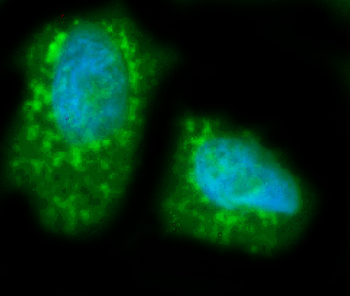 Anti-LIPC Antibody