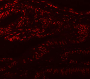 Anti-MBNL1 Antibody
