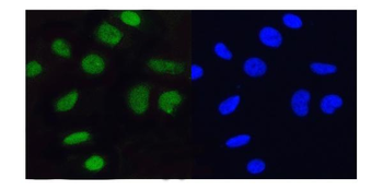 Anti-MCM5 Antibody
