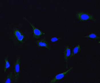 Anti-ME2 Antibody