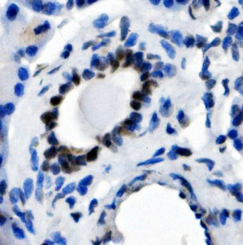 Anti-NFIC/CTF Antibody