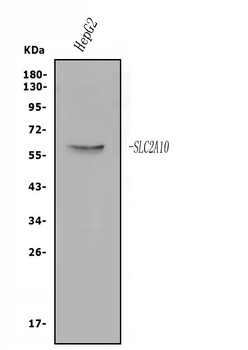 GLUT10/SLC2A10 Antibody