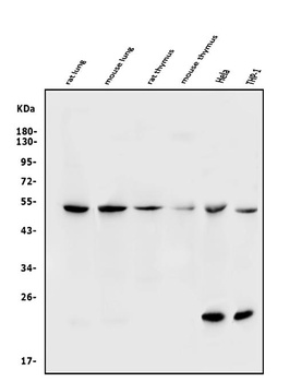 TRIM21/SS-A Antibody