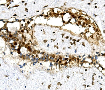 Anti-U2AF65/U2AF2 Antibody