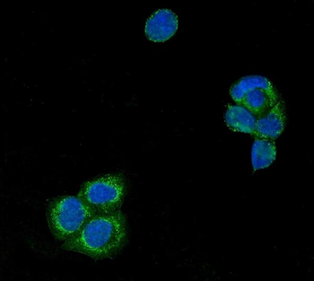 Anti-USP21 Antibody