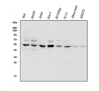 VPS4B/MIG1 Antibody