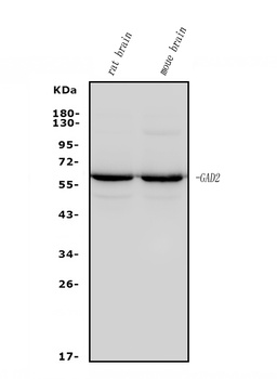 GAD65/GAD2 Antibody (monoclonal, 4E12)