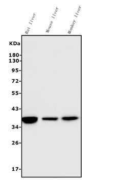 liver Arginase/ARG1 Antibody (monoclonal, 2B12)