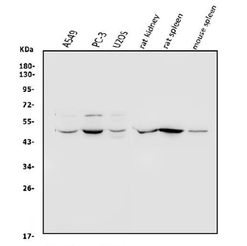 Arp3/ACTR3 Antibody